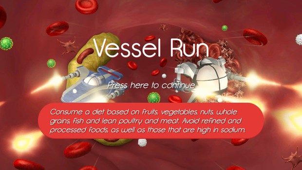ڵĴ(Vessel Run)ͼ