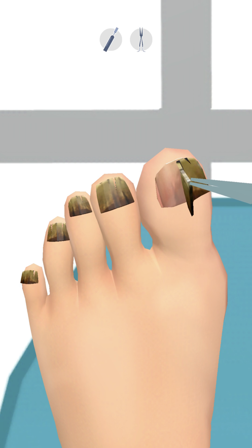 foot clinic足部护理游戏截图