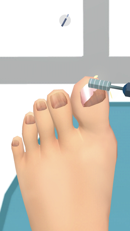 foot clinic足部护理游戏截图