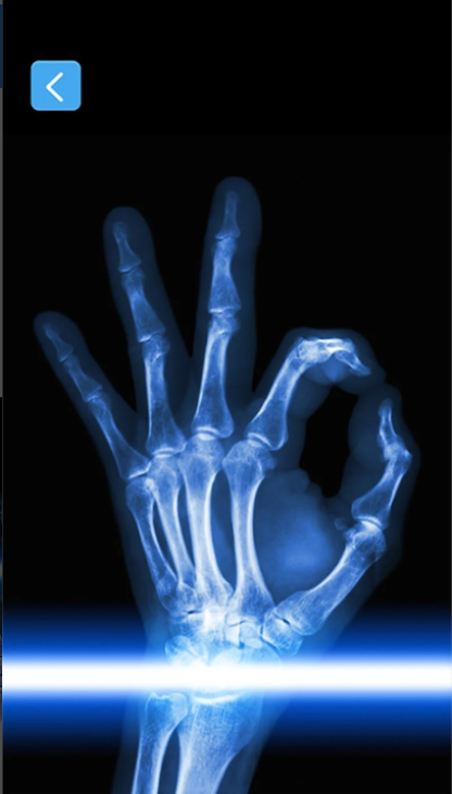 X射线手机骨骼扫描仪软件(Xray Scanner)截图