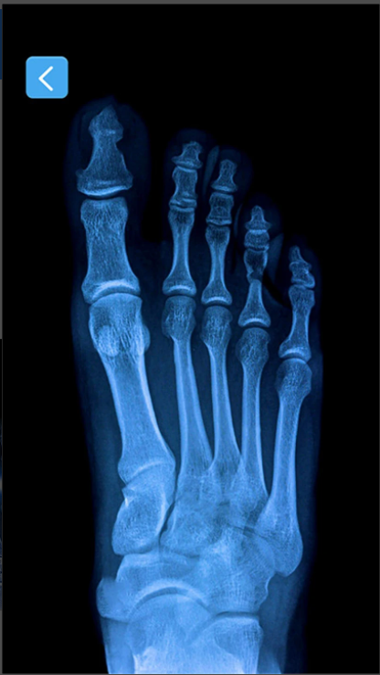 X射线手机骨骼扫描仪软件(Xray Scanner)截图