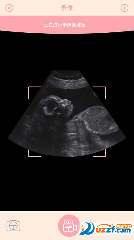 胎儿相机app截图