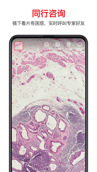 ������app�ٷ����ͼ