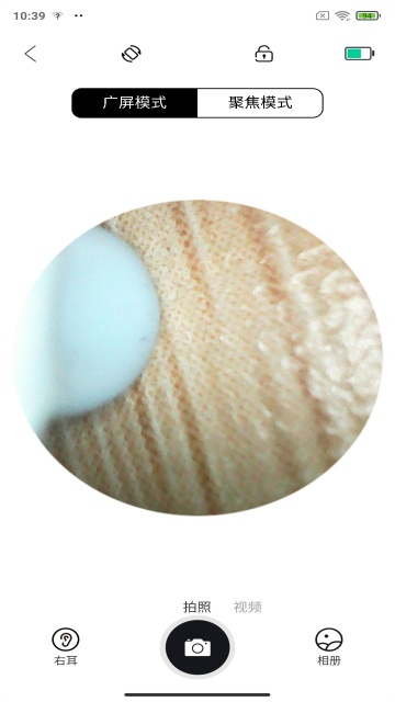 UseeEar可视耳镜APP UseeEar可视耳镜APP